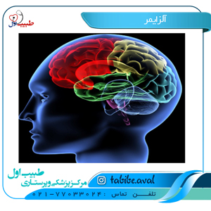 درمان آلزایمر | طبیب اول