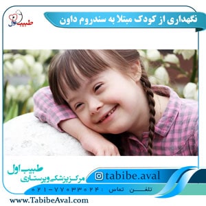 نگهداری از کودک سندروم داون در منزل