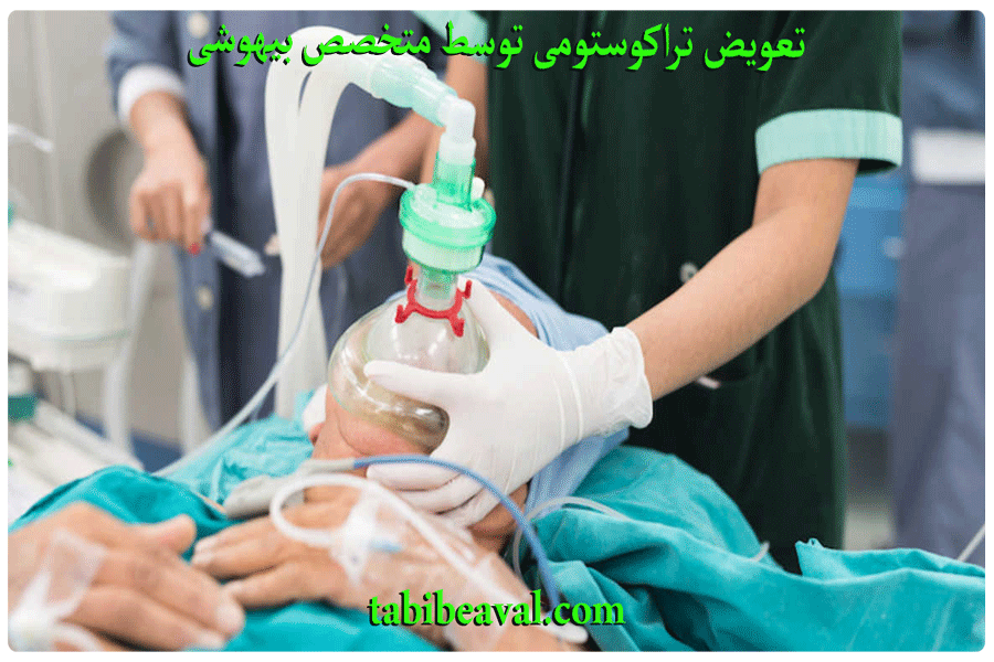 تعویض تراکوستومی توسط متخصص بیهوشی