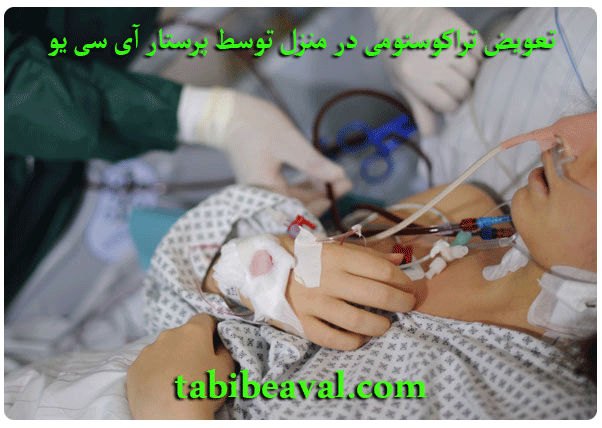 تعویض تراکوستومی در منزل توسط پرستار آی سی یو