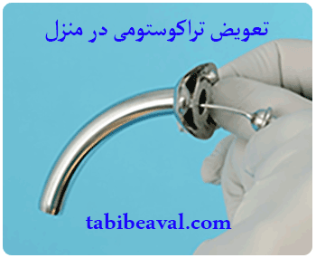 تعویض تراکوستومی درمنزل