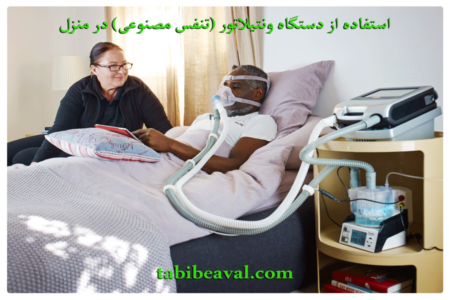 دستگاه ونتیلاتور (تنفس مصنوعی) در منزل