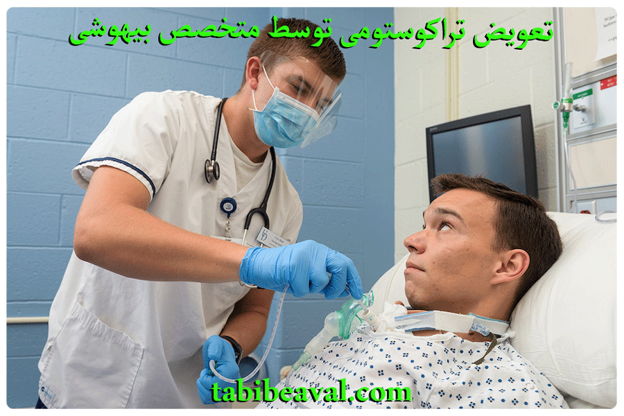 تعویض تراکوستومی توسط متخصص بیهوشی