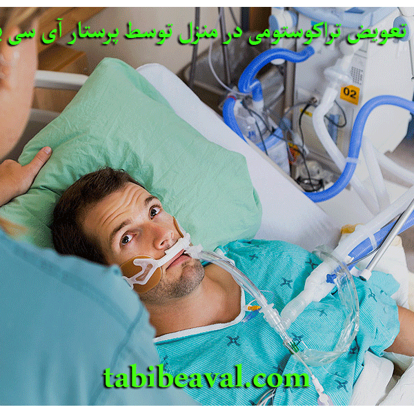 تعویض تراکوستومی در منزل توسط پرستار آی سی یو