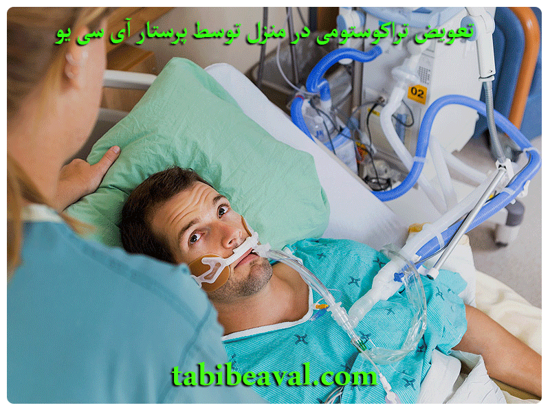 تعویض تراکوستومی در منزل توسط پرستار آی سی یو