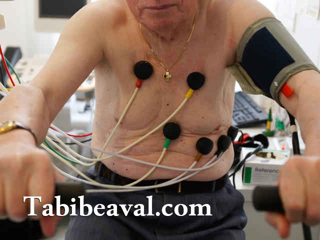 انجام نوار قلب در منزل | طبیب اول