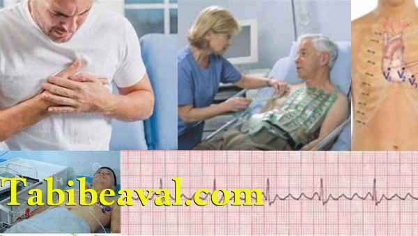 انجام نوار قلب در منزل | طبیب اول