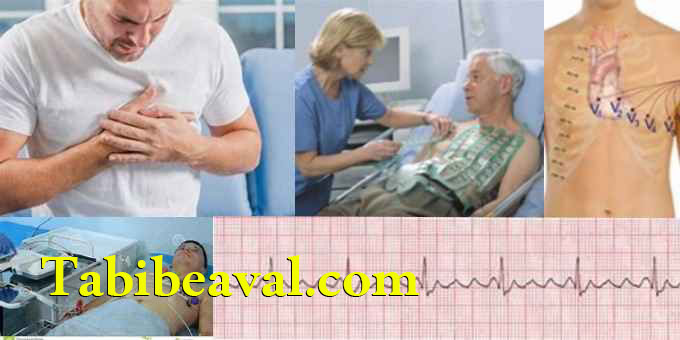 انجام نوار قلب در منزل | طبیب اول