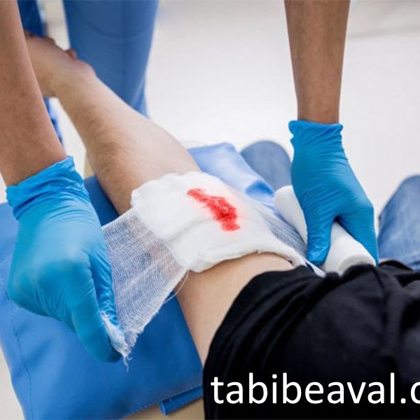 پانسمان و تمیزسازی زخم در منزل طبیب اول