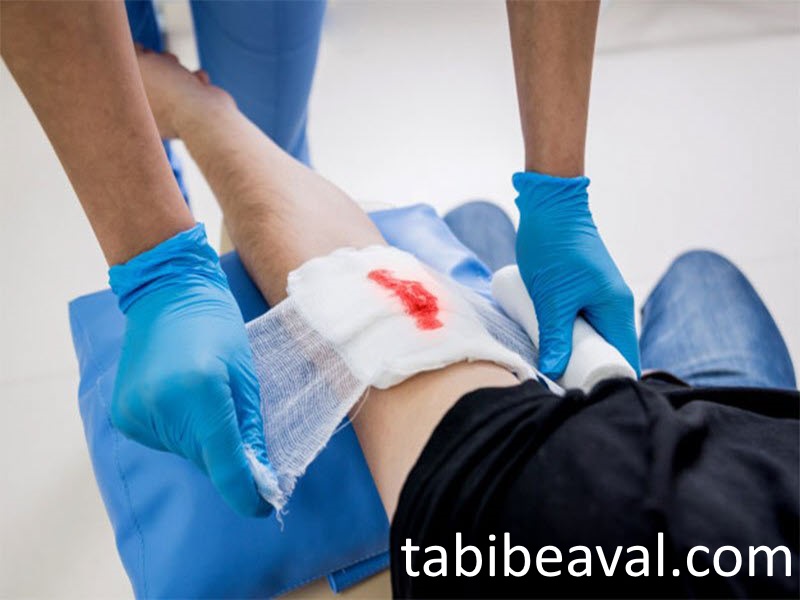 پانسمان و تمیزسازی زخم در منزل  طبیب اول