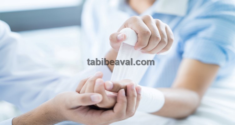 مراقبت از زخم در منزل | طبیب اول