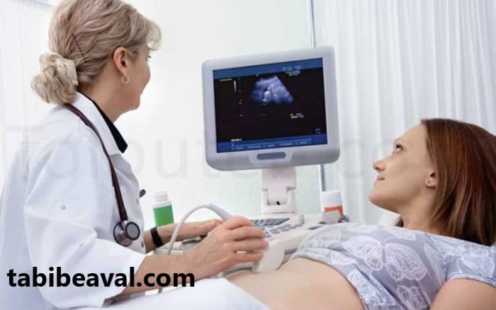 انجام سونوگرافی در منزل - طبیب اول