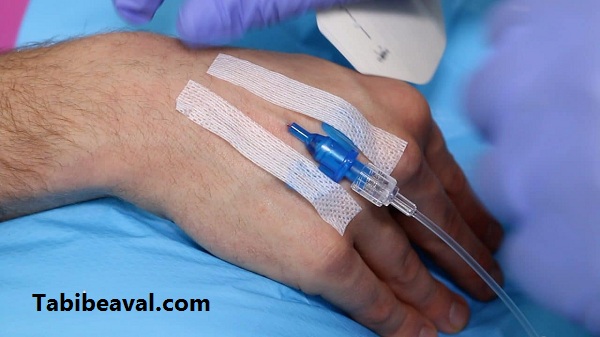 آموزش سرم تراپی در منزل - طبیب اول