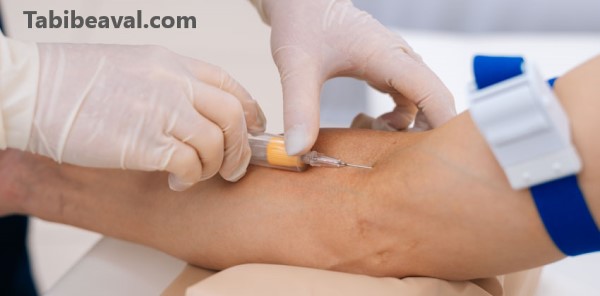 هزینه سرم تراپی در منزل چقدر است؟ - طبیب اول