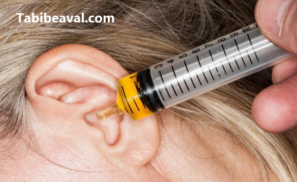 شستشوی گوش ها در منزل - طبیب اول