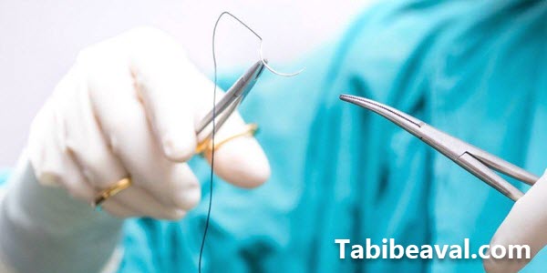 بخیه بریدگی در منزل شرق تهران طبیب اول