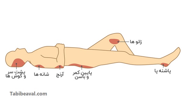 معالجه زخمهای حاد در منزل | طبیب اول