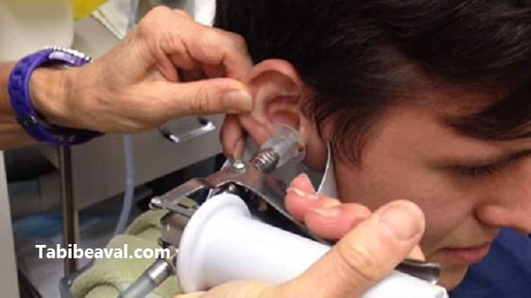 پزشک شستشوی گوش در منزل | طبیب اول