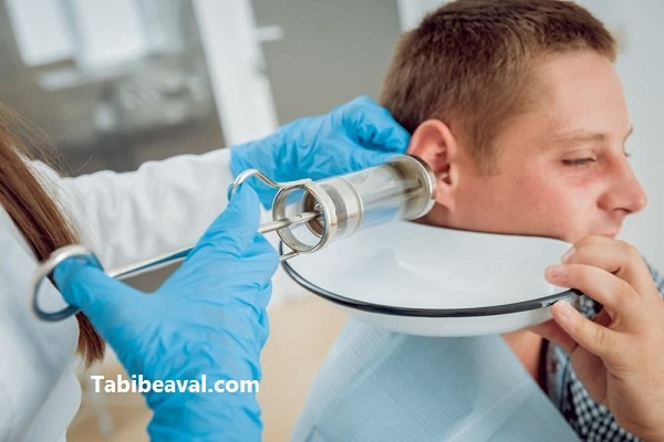 پزشک شستشوی گوش در منزل | طبیب اول