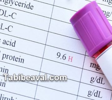 اسید اوریک چیست و چگونه درمان می شود؟ | طبیب اول