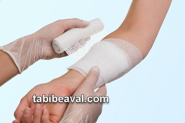 درمان زخم های بعد از شیمی درمانی در منزل | طبیب اول