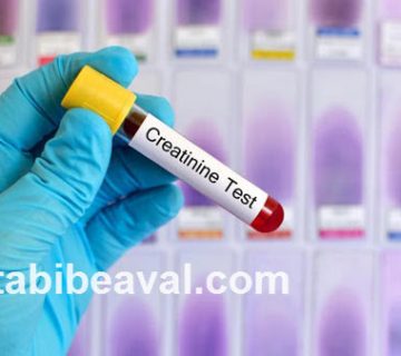 راه های پایین آوردن اوره و کراتین خون | طبیب اول