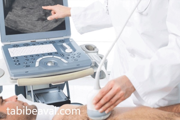 اکوکاردیوگرافی در منزل شرق تهران | طبیب اول