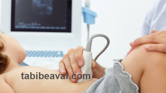 هزینه سونوگرافی کبد و مجاری صفراوی در منزل چقدر است؟ | طبیب اول