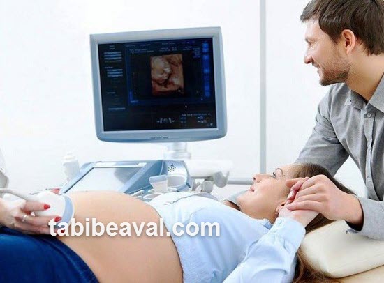 عوامل مؤثر بر هزینه سونوگرافی در منزل | طبیب اول