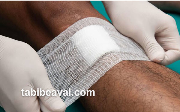 آشنایی با پانسمان زخم | طبیب اول