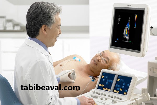 هزینه اکوکاردیوگرافی در منزل | طبیب اول