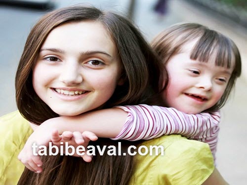 پرستاری از کودکان سندرم داون در منزل | طبیب اول