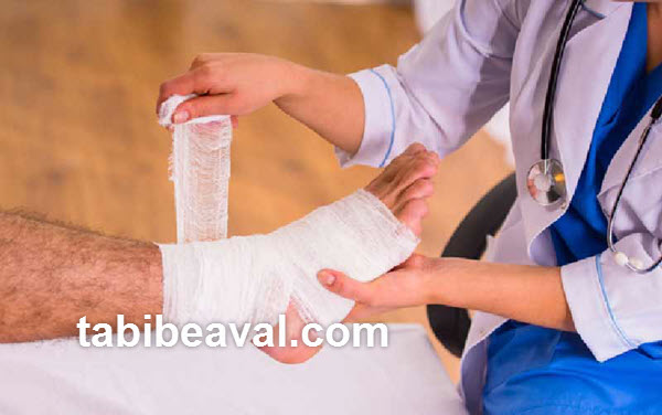 درمان زخم سوختگی در منزل | طبیب اول