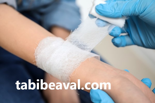 مزیت های پانسمان زخم در منزل | طبیب اول