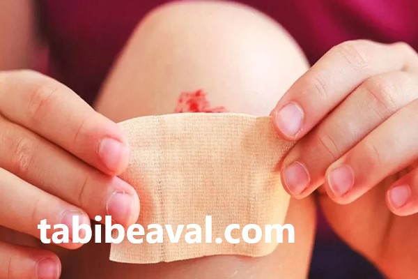 نحوه پانسمان زخم در منزل | طبیب اول