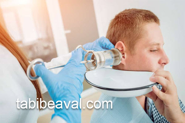 نحوه شستشوی گوش توسط پزشکان در منزل | طبیب اول 