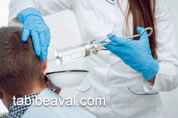 آموزش شستشوی گوش در منزل | طبیب اول