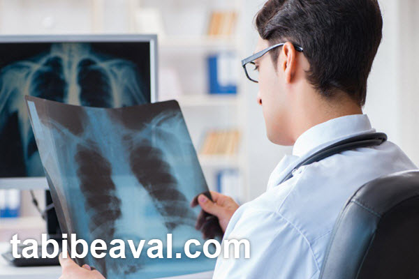 وظایف پزشک برای انجام رادیوگرافی در منزل | طبیب اول