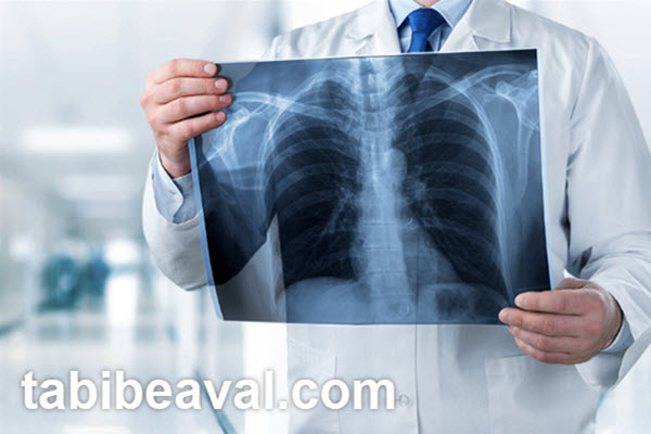 بهترین مرکز تخصصی رادیولوژی در منزل | طبیب اول