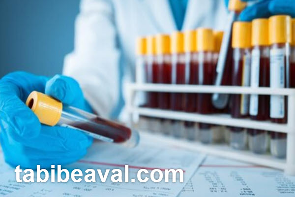 مزایای آزمایش خون در منزل | طبیب اول