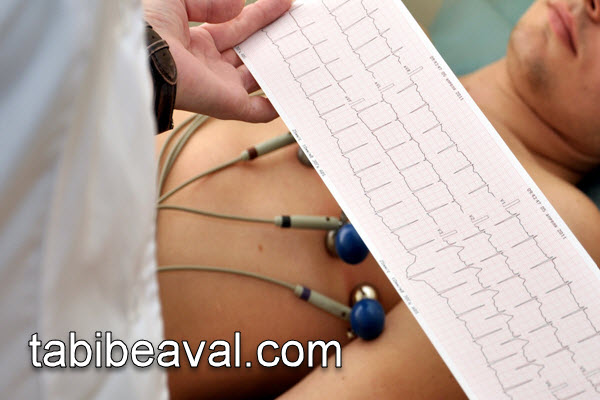 انجام تست نوار قلب در مرکز پزشکی معتبر | طبیب اول