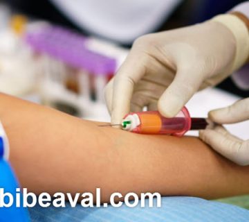 هزینه آزمایش خون در منزل | طبیب اول