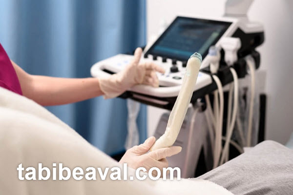 هزینه سونوگرافی شکم و لگن در نیاوران | طبیب اول