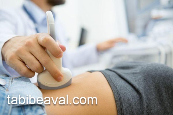 بهترین زمان برای انجام سونوگرافی شکم و لگن | طبیب اول