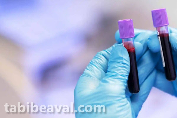 آزمایش خون در منزل شمال تهران