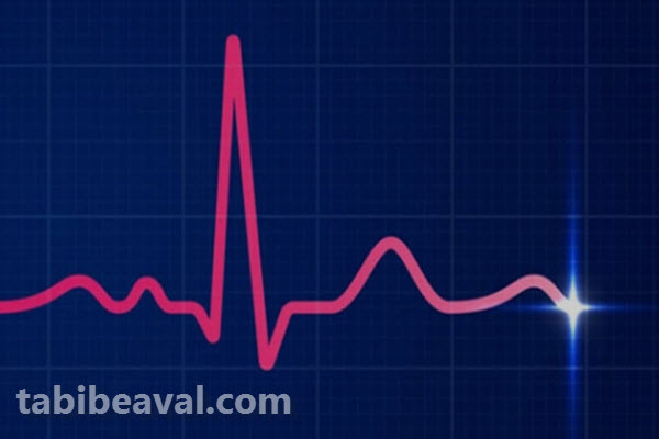 انجام نوار قلب در منزل میرداماد تهران