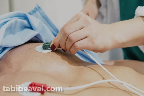 مزایای انجام نوار قلب در منزل