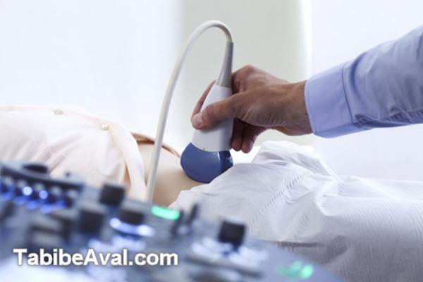 قیمت سونوگرافی در منزل تهران چقدر است؟ | طبیب اول