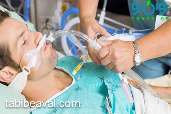 هزینه های اجاره دستگاه ساکشن | طبیب اول