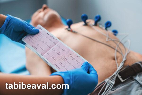 ارائه خدمات نوار قلب در منزل